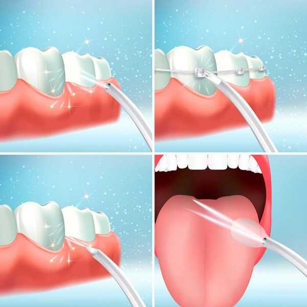 Irrigador Dental Recargable Portátil, Denter, 4 W, 6 x 6 x 21 cm INNOVAGOODS